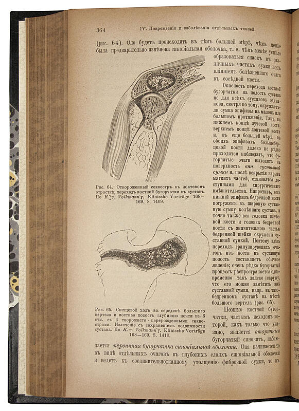 Антикварное издание «Д-р H. Lossen. Руководство к общей хирургии»