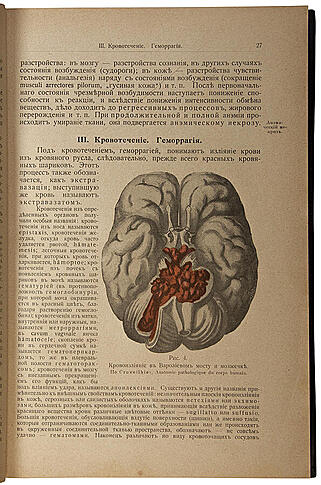 Антикварная книга «Основы патологической анатомии»