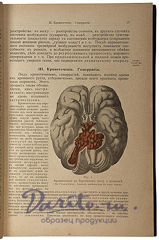 Антикварная книга «Основы патологической анатомии»